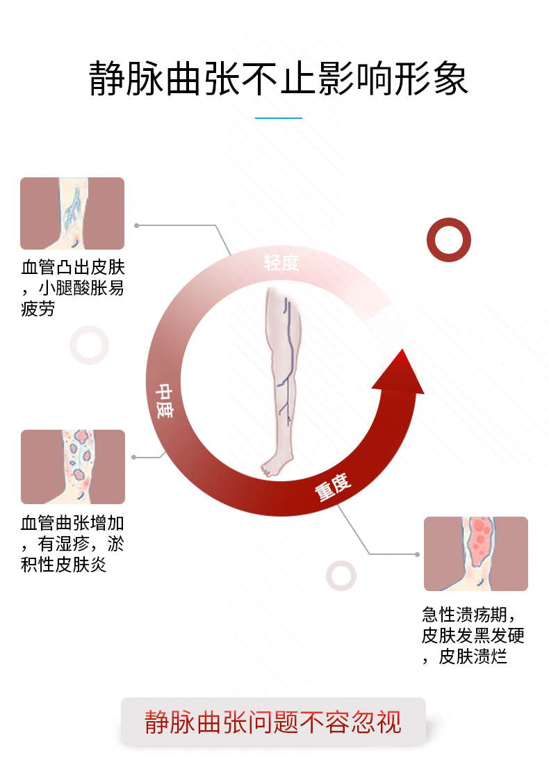 天猫静脉曲张膏详情页（1）5_07.jpg